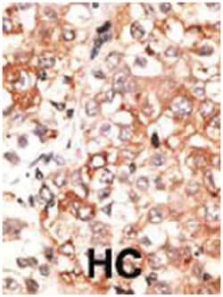 GJC1, Rabbit, Polyclonal Antibody, Abnova 400&mu;L; Unlabeled:Antibodies,