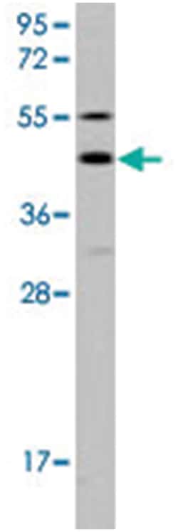 GJA8, Rabbit, Polyclonal Antibody, Abnova 400 &mu;L | Buy Online | Abnova Corporation | Fisher Scientific