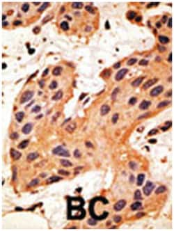 GJA8, Rabbit, Polyclonal Antibody, Abnova 400 &mu;L | Buy Online | Abnova Corporation | Fisher Scientific