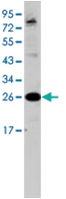 FREQ Rabbit anti-Human, Polyclonal Antibody, Abnova 400&mu;L; Unlabeled:Antibodies,