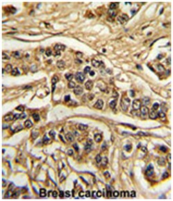 FREQ Rabbit anti-Human, Polyclonal Antibody, Abnova 400&mu;L; Unlabeled:Antibodies,