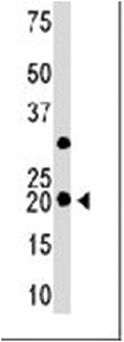 HPCAL1, Rabbit, Polyclonal Antibody, Abnova 400 &mu;L | Buy Online | Abnova Corporation | Fisher Scientific