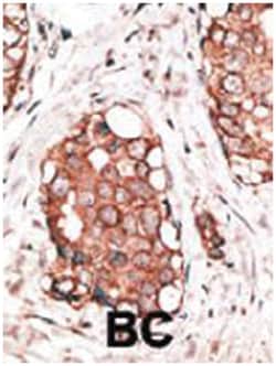 HPCAL1, Rabbit, Polyclonal Antibody, Abnova 400 &mu;L | Buy Online | Abnova Corporation | Fisher Scientific