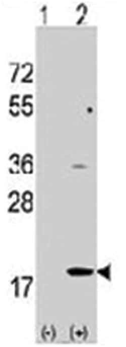 HPCAL1, Rabbit, Polyclonal Antibody, Abnova 400 &mu;L | Buy Online | Abnova Corporation | Fisher Scientific