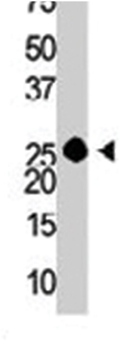 GUCA1A, Rabbit, Polyclonal Antibody, Abnova 400 &mu;L | Buy Online | Abnova Corporation | Fisher Scientific