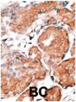 GUCA1A, Rabbit, Polyclonal Antibody, Abnova 400 &mu;L | Buy Online | Abnova Corporation | Fisher Scientific