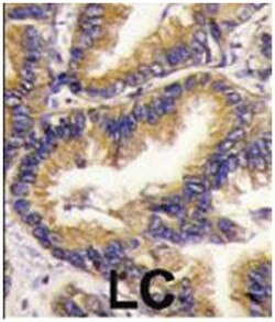 URM1 Rabbit anti-Human, Polyclonal Antibody, Abnova 400 &mu;L | Buy Online | Abnova | Fisher Scientific