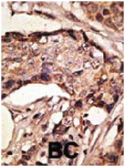 SIGLEC9, Rabbit, Polyclonal Antibody, Abnova 400&mu;L; Unlabeled:Antibodies,