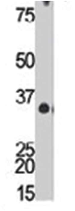 GRM8 Rabbit anti-Human, Mouse, Polyclonal Antibody, Abnova 400 &mu;L | Buy Online | Abnova Corporation | Fisher Scientific