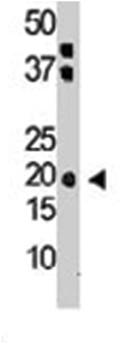 IL28A, Rabbit, Polyclonal Antibody, Abnova 400 &mu;L | Buy Online | Abnova Corporation | Fisher Scientific
