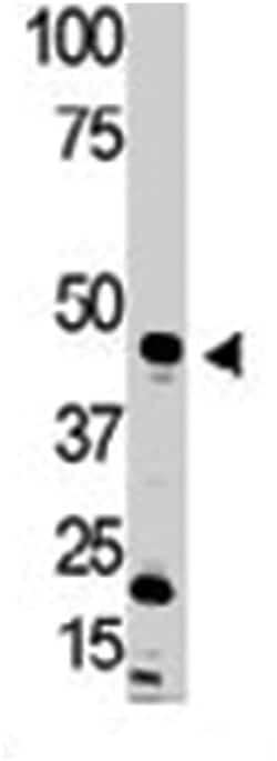BMP15 Rabbit anti-Human, Polyclonal Antibody, Abnova 400 &mu;L | Buy Online | Abnova Corporation | Fisher Scientific