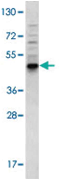 BMP3 Rabbit anti-Human, Polyclonal Antibody, Abnova 400&mu;L; Unlabeled:Antibodies,