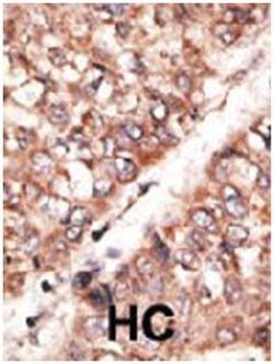 BMP3 Rabbit anti-Human, Polyclonal Antibody, Abnova 400&mu;L; Unlabeled:Antibodies,