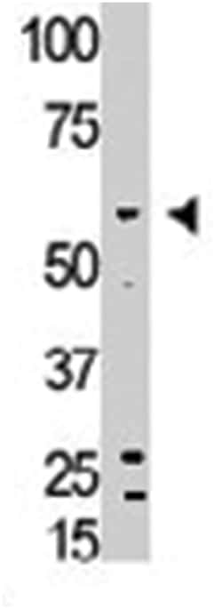 BMP6 Rabbit anti-Human, Polyclonal Antibody, Abnova 400 &mu;L | Buy Online | Abnova | Fisher Scientific