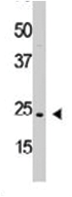 PDGFA Rabbit anti-Human, Polyclonal Antibody, Abnova 400 &mu;L | Buy Online | Abnova Corporation | Fisher Scientific