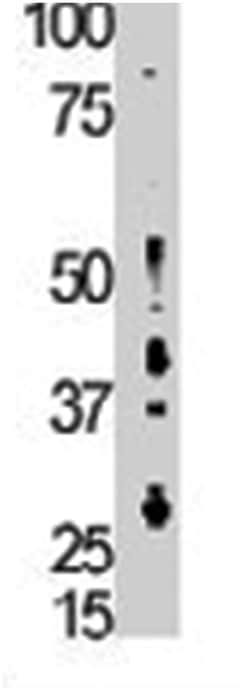 BMP2K, Rabbit, Polyclonal Antibody, Abnova 400 &mu;L | Buy Online | Abnova Corporation | Fisher Scientific