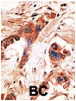 BMP2K, Rabbit, Polyclonal Antibody, Abnova 400 &mu;L | Buy Online | Abnova Corporation | Fisher Scientific