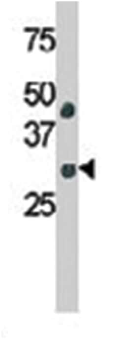 YEATS4 Rabbit anti-Human, Polyclonal Antibody, Abnova 400 &mu;L | Buy Online | Abnova Corporation | Fisher Scientific