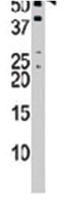 NUP50, Rabbit, Polyclonal Antibody, Abnova 400&mu;L; Unlabeled:Antibodies,