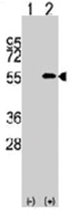 NUP50, Rabbit, Polyclonal Antibody, Abnova 400&mu;L; Unlabeled:Antibodies,