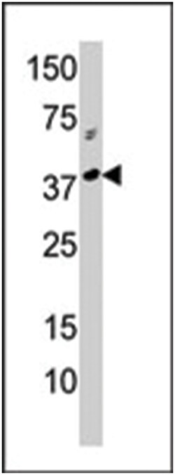 RCL1, Rabbit, Polyclonal Antibody, Abnova 400&mu;L; Unlabeled:Antibodies,
