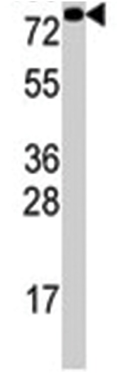 EIF4B Rabbit anti-Human, Polyclonal Antibody, Abnova 400 &mu;L | Buy Online | Abnova Corporation | Fisher Scientific