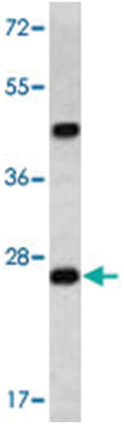 dcr-1, Rabbit, Polyclonal Antibody, Abnova 400&mu;L; Unlabeled:Antikörper