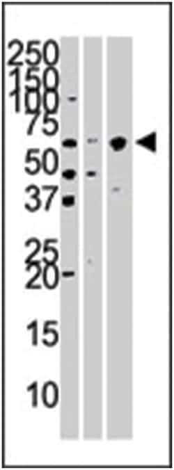 KPNA4 Rabbit anti-Human, Mouse, Polyclonal Antibody, Abnova 400&mu;L; Unlabeled:Antibodies,