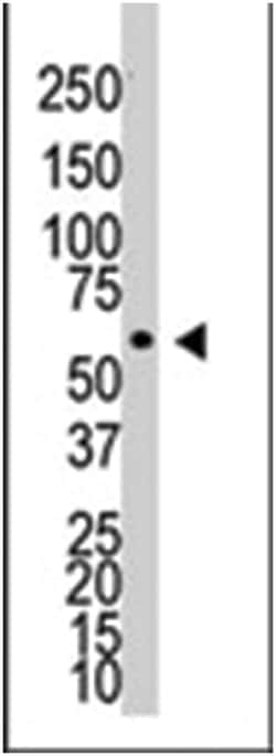 BMPR1A Rabbit anti-Human, Polyclonal Antibody, Abnova 400 &mu;L | Buy Online | Abnova Corporation | Fisher Scientific