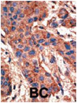 BMPR1A Rabbit anti-Human, Polyclonal Antibody, Abnova 400 &mu;L | Buy Online | Abnova Corporation | Fisher Scientific