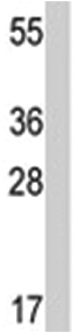 BMPR1A Rabbit anti-Human, Polyclonal Antibody, Abnova 400&mu;L; Unlabeled:Antibodies,