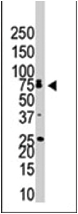 BMPR1B Rabbit anti-Human, Mouse, Polyclonal Antibody, Abnova 400&mu;L;