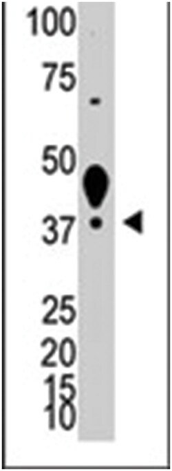 LYVE1 Rabbit anti-Human, Mouse, Polyclonal Antibody, Abnova 400&mu;L; Unlabeled:Antibodies,