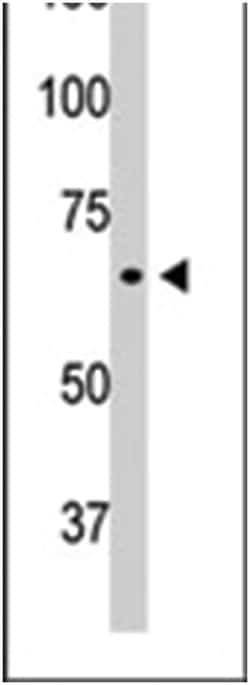 GFAP Rabbit anti-Human, Mouse, Polyclonal Antibody, Abnova 400 &mu;L | Buy Online | Abnova Corporation | Fisher Scientific