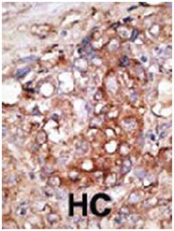 MAP2, Rabbit, Polyclonal Antibody, Abnova 400 &mu;L | Buy Online | Abnova Corporation | Fisher Scientific