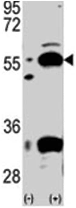 PDHX Rabbit anti-Human, Polyclonal Antibody, Abnova 400 &mu;L | Buy Online | Abnova Corporation | Fisher Scientific