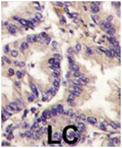 VEGFC Rabbit anti-Human, Polyclonal Antibody, Abnova 400&mu;L; Unlabeled:Antibodies,
