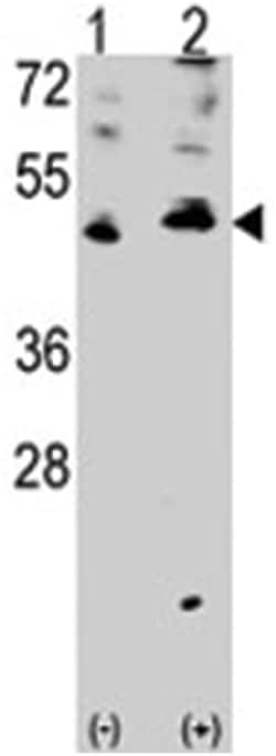 VEGFC Rabbit anti-Human, Polyclonal Antibody, Abnova 400&mu;L; Unlabeled:Antibodies,