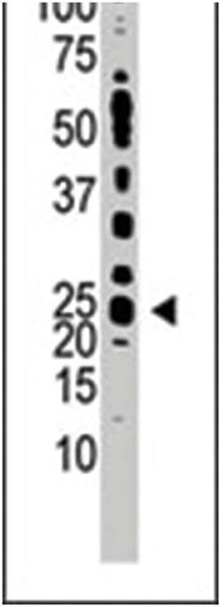 TDGF1 Rabbit anti-Human, Polyclonal Antibody, Abnova 400 &mu;L | Buy Online | Abnova Corporation | Fisher Scientific
