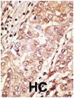 TDGF1 Rabbit anti-Human, Polyclonal Antibody, Abnova 400 &mu;L | Buy Online | Abnova Corporation | Fisher Scientific