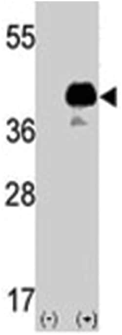 SOX2 Rabbit anti-Human, Polyclonal Antibody, Abnova 400 &mu;L | Buy Online | Abnova Corporation | Fisher Scientific