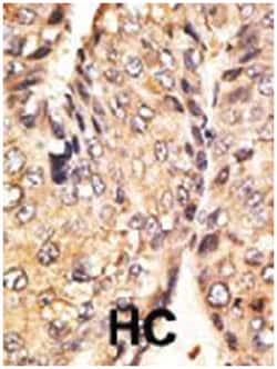 GDF10, Rabbit, Polyclonal Antibody, Abnova 400 &mu;L | Buy Online | Abnova | Fisher Scientific