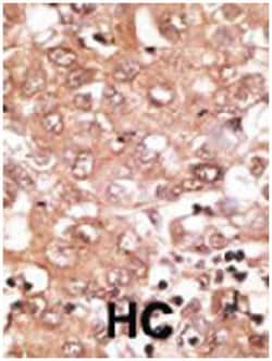 GDF2 (N-terminus), Rabbit, Polyclonal Antibody, Abnova 400&mu;L; Unlabeled:Antibodies,