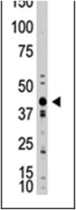 MSTN Rabbit anti-Human, Polyclonal Antibody, Abnova 400 &mu;L | Buy Online | Abnova Corporation | Fisher Scientific