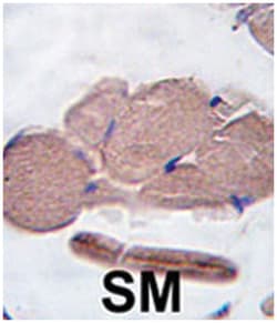 MSTN Rabbit anti-Human, Polyclonal Antibody, Abnova 400 &mu;L | Buy Online | Abnova Corporation | Fisher Scientific