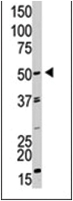 GDF9 Rabbit anti-Human, Polyclonal Antibody, Abnova 400&mu;L; Unlabeled:Antibodies,