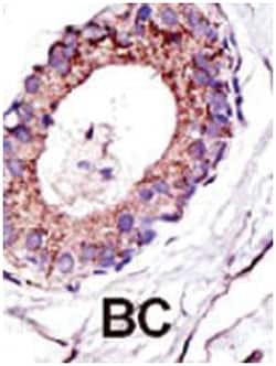 UBE2D1, Rabbit, Polyclonal Antibody, Abnova 400&mu;L; Unlabeled:Antibodies,