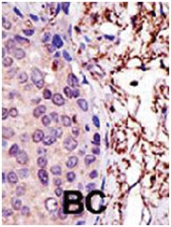 UBE2L3 Rabbit anti-Human, Polyclonal Antibody, Abnova 400 &mu;L | Buy Online | Abnova Corporation | Fisher Scientific