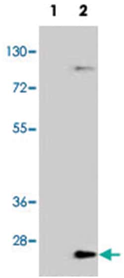 UBE2H, Rabbit, Polyclonal Antibody, Abnova 400&mu;L; Unlabeled:Antibodies,