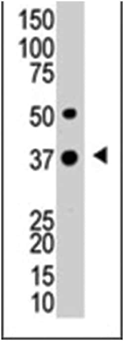 UCHL5, Rabbit, Polyclonal Antibody, Abnova 400&mu;L; Unlabeled:Antibodies,